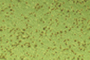 Replication Competent Adenovirus Assay